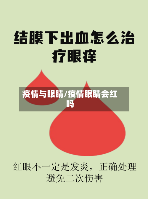 疫情与眼睛/疫情眼睛会红吗-第2张图片