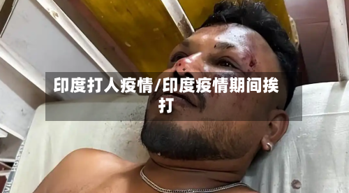 印度打人疫情/印度疫情期间挨打-第3张图片